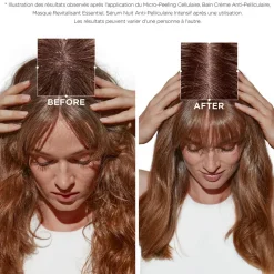 Kérastase Bain crème anti-pelliculaire Symbiose Hot