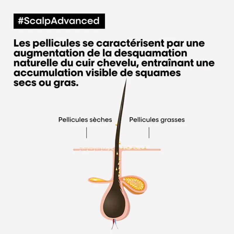 L’Oréal Professionnel Paris Routine anti-pellicules grasses Scalp Advanced New