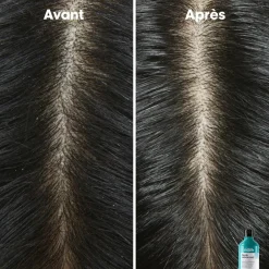 L’Oréal Professionnel Paris Shampooing dermo-clarifiant anti-pelliculaire Scalp Advanced 500ml Discount