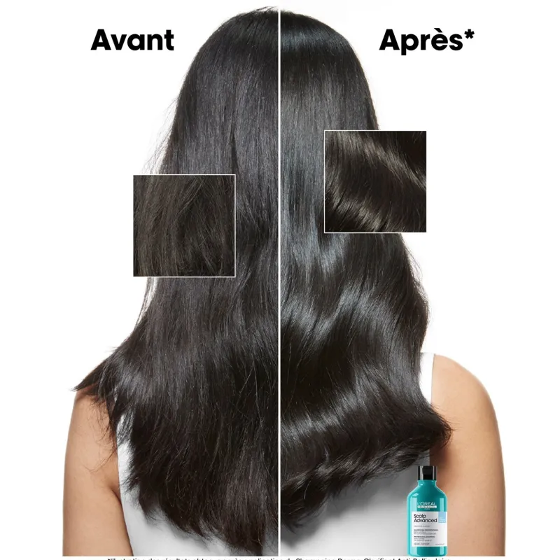 L’Oréal Professionnel Paris Shampooing dermo-clarifiant anti-pelliculaire Scalp Advanced 300ml Hot