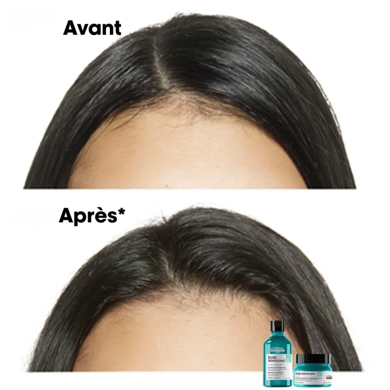 L’Oréal Professionnel Paris Shampooing dermo-purifiant anti-gras Scalp Advanced 300ml