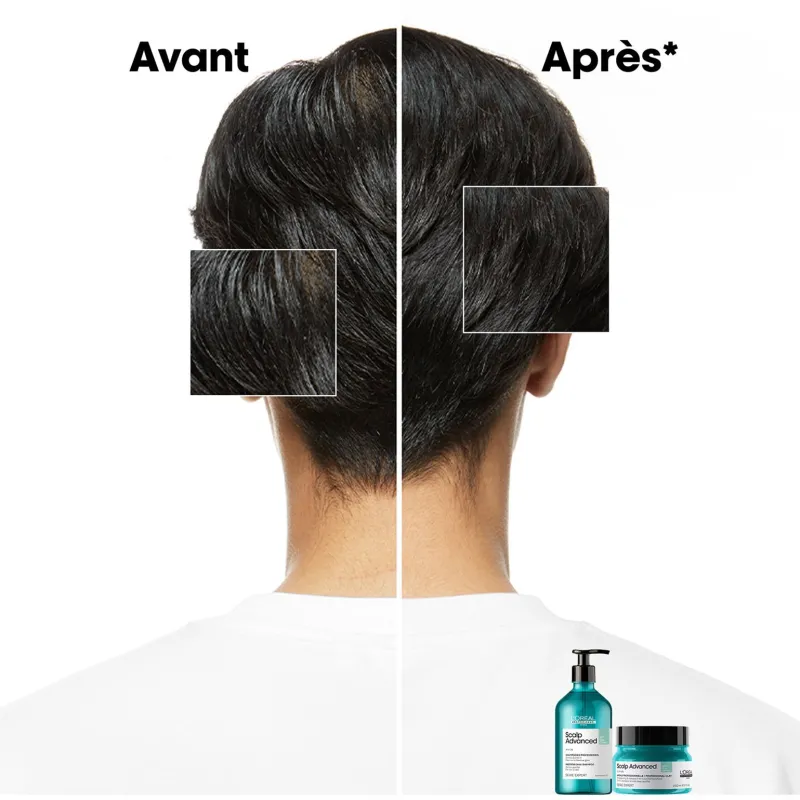 L’Oréal Professionnel Paris Shampooing dermo-purifiant anti-gras Scalp Advanced 500ml Clearance